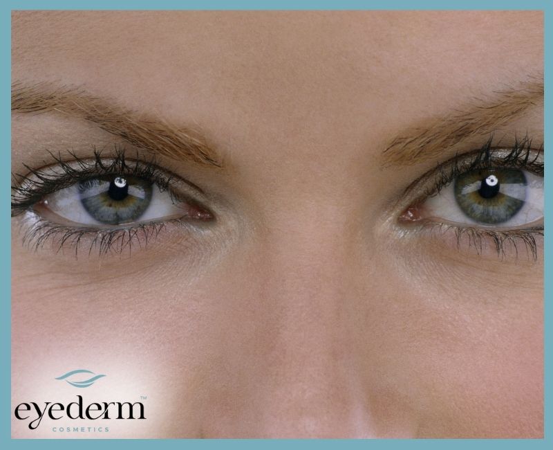 The Most Vulnerable Skin on Your Face  (and Why It Deserves Special Treatment)