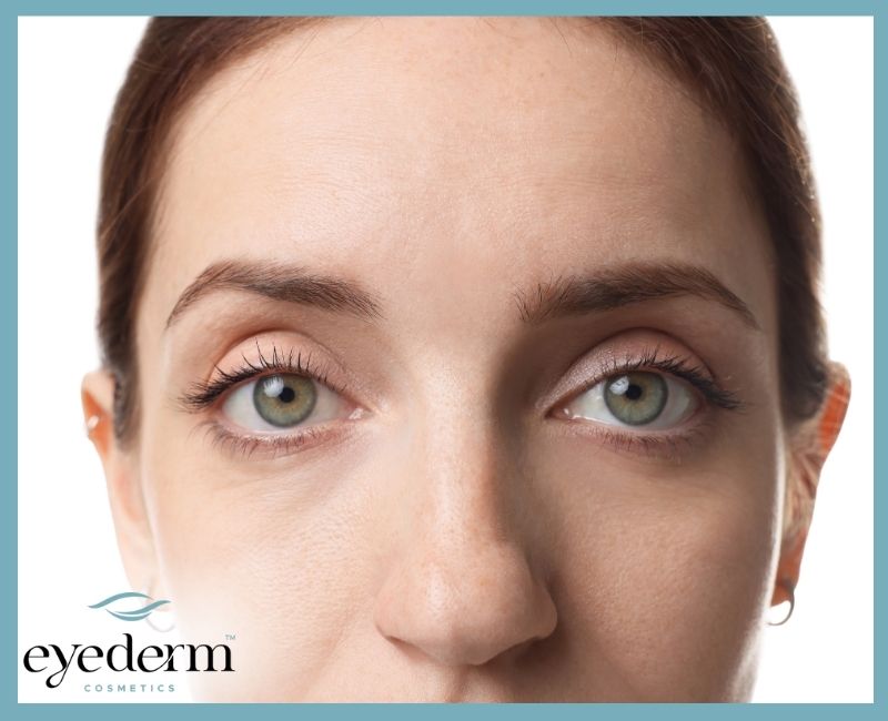 The Delicate Truth About Under-Eye Skin